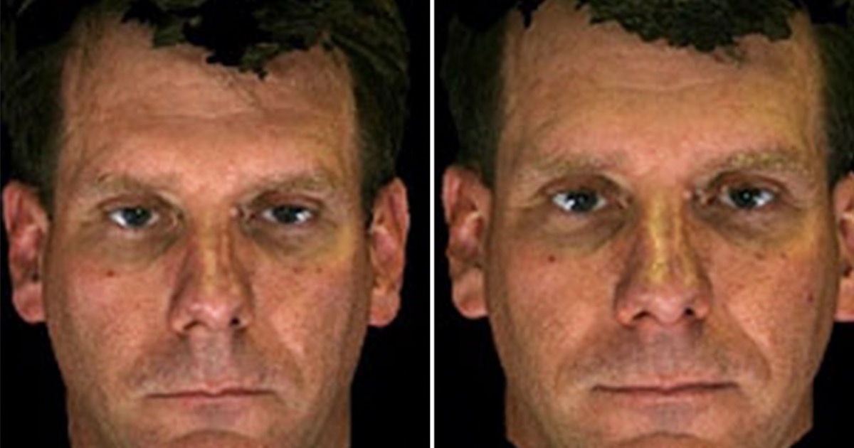 Why You Look Older: How Snoring Secretly Changes Your Face (And What To Do About It)