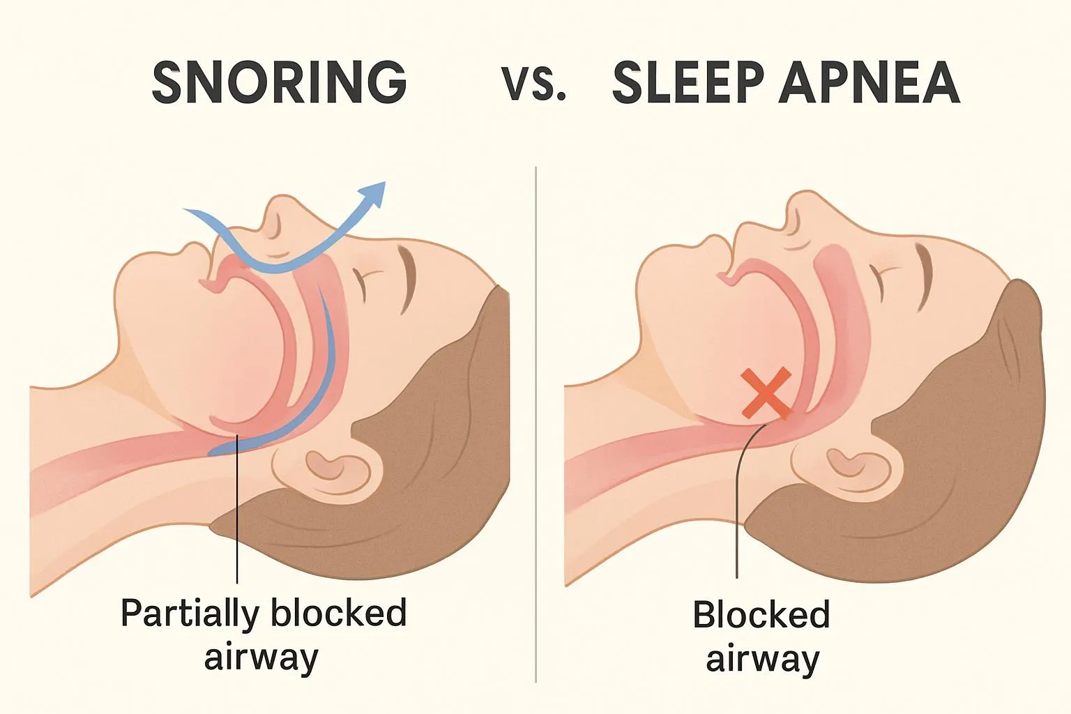 Snoring vs Sleep Apnea illustration